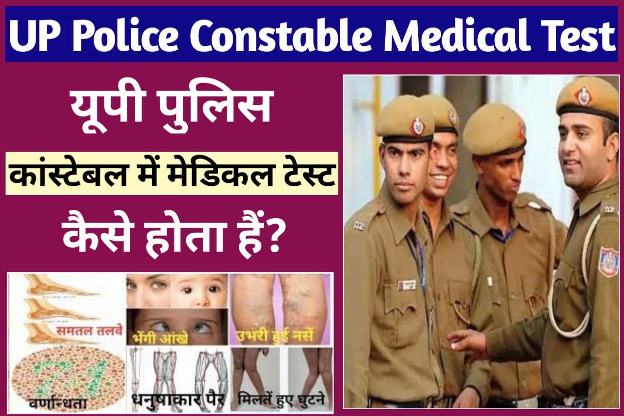 UP Police Constable Me Medical Test Kaise Hota He