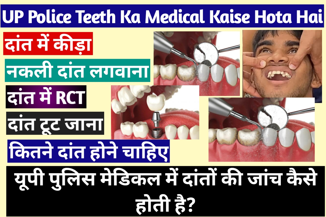 UP Police Me Teeth Ka Medical Kaise Hota Hai